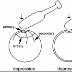 Blunt Force Trauma: Definition, Symptoms & Examples